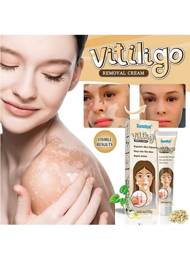 سوميفون مرهم كريم لإزالة البهاق 20 غرام، علاج البهاق الجلدي، كريم للعناية بالبهاق لتقليل البقع البيضاء وتحسين تصبغ الجلد - Image 5